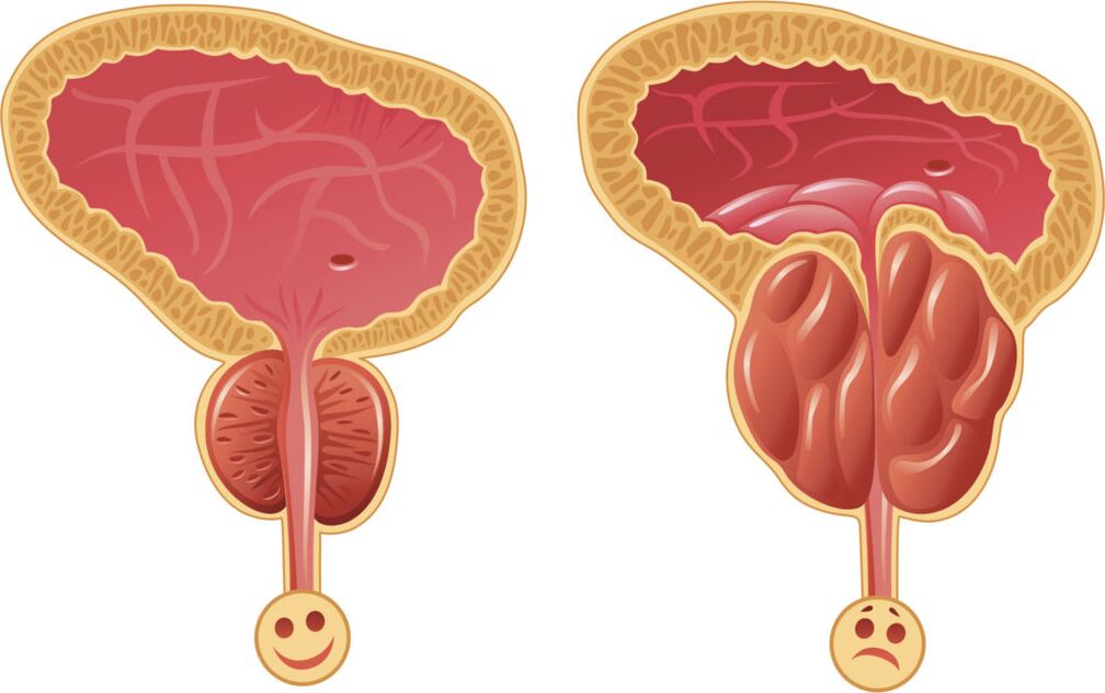 urotrin romania