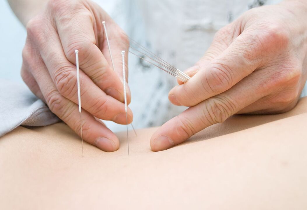The doctor puts needles